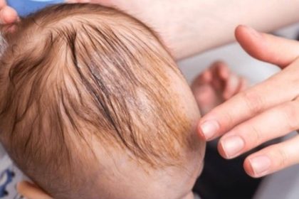 How To Get Baby Oil Out Of Hair